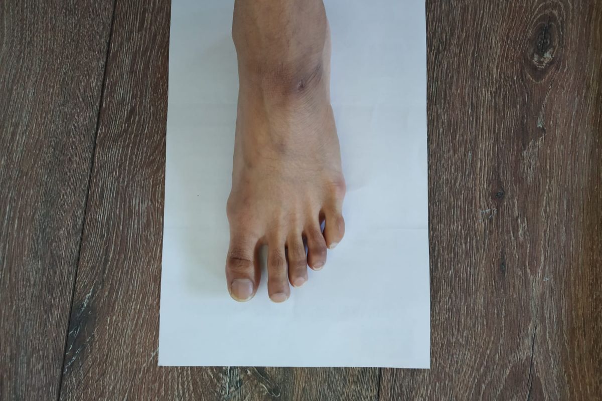 Bare foot on A4 paper to measure foot length at home